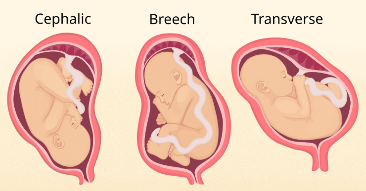 Baby Position in the Womb
