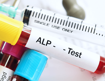 Service 92 illustration