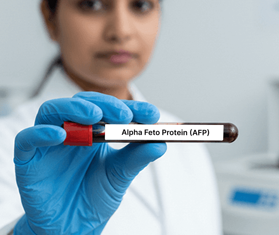 Service 116 illustration