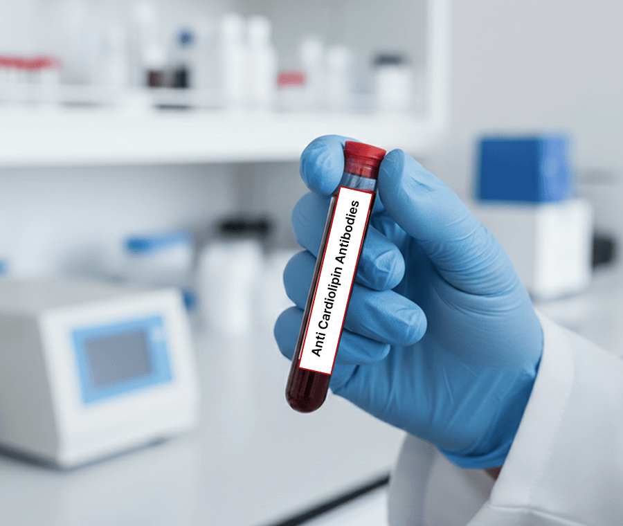 Service 74 illustration