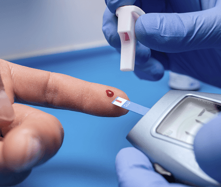 Service 11 illustration