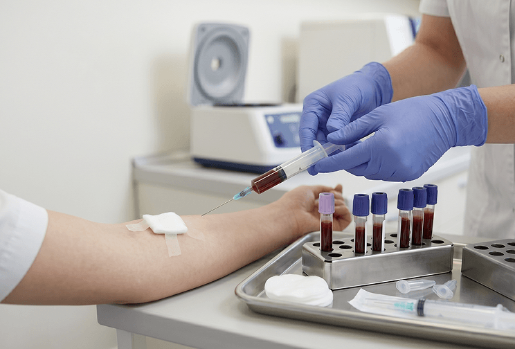 Albumin blood test