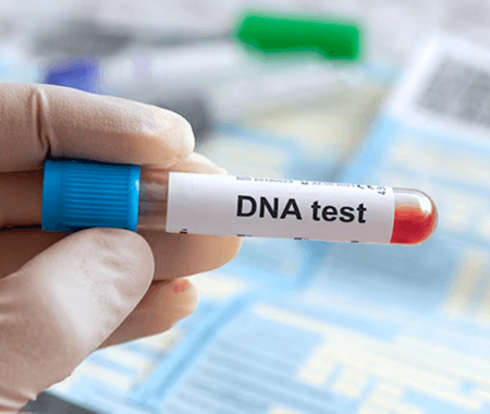 Service 3 illustration