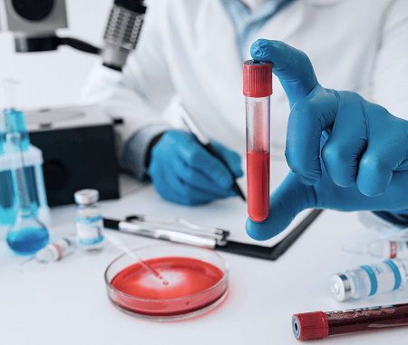 Service 2 illustration