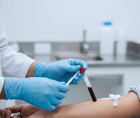 Service 3 illustration