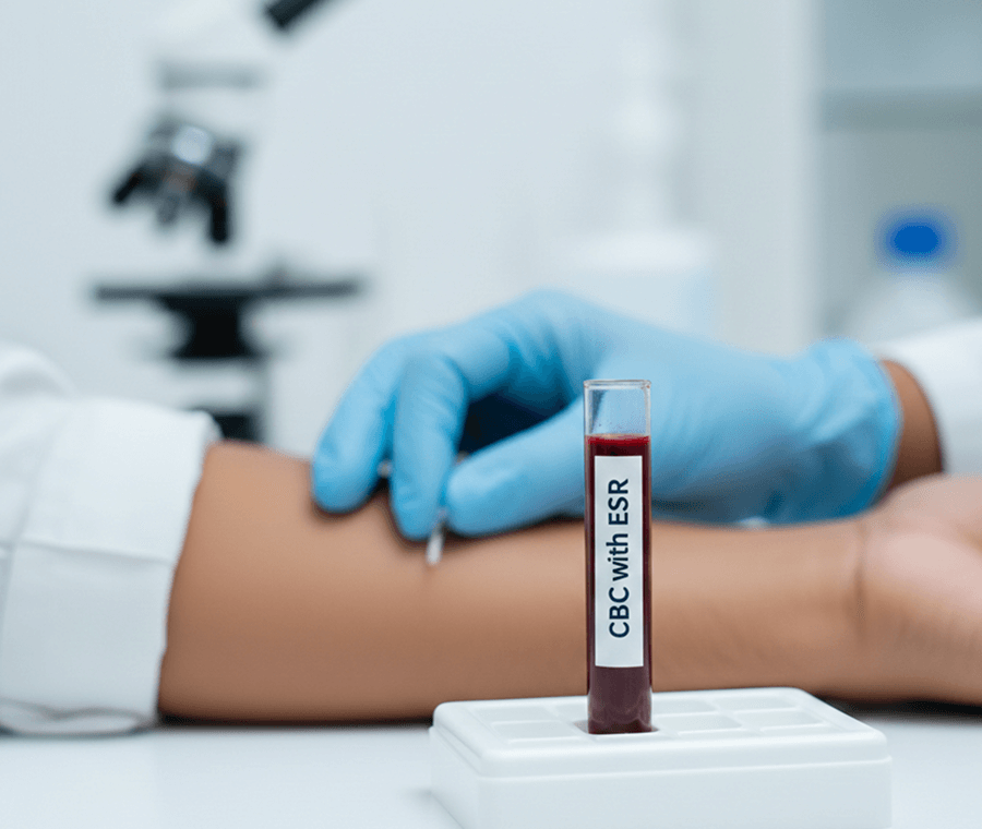 Service 9 illustration