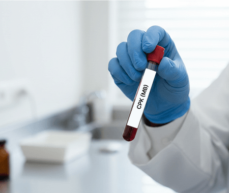 Service 151 illustration