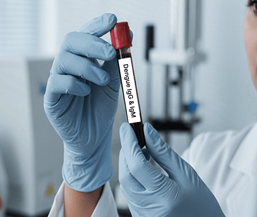 Service 138 illustration