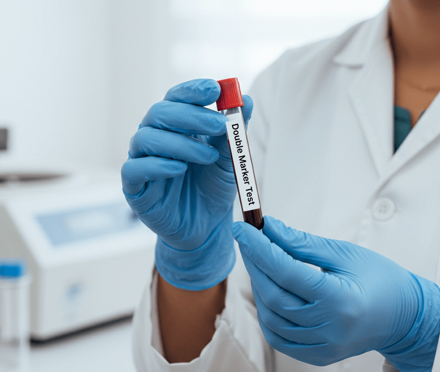 Service 63 illustration