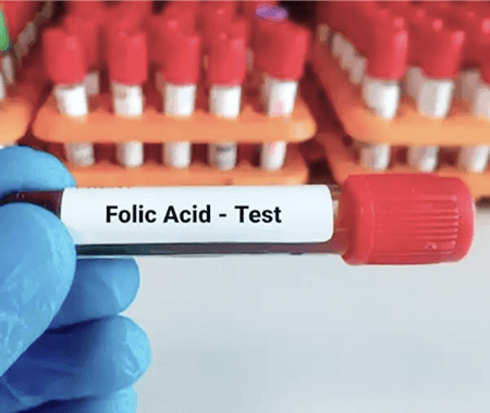 Service 10 illustration