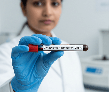 Service 155 illustration