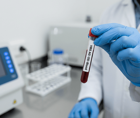 Service 83 illustration