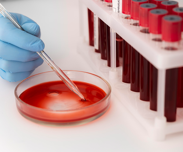 Service 30 illustration