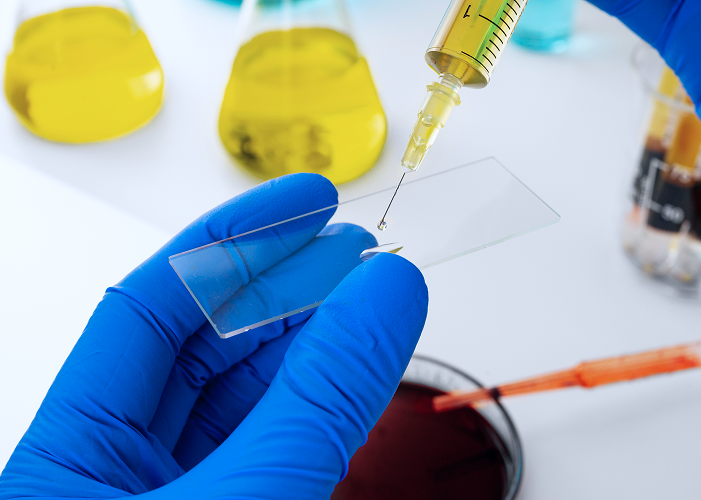 Service 25 illustration