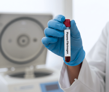 Service 5 illustration