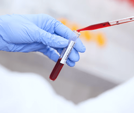 Service 125 illustration