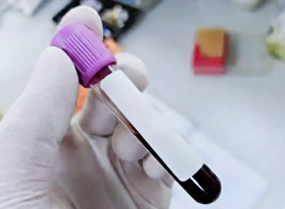 Service 24 illustration