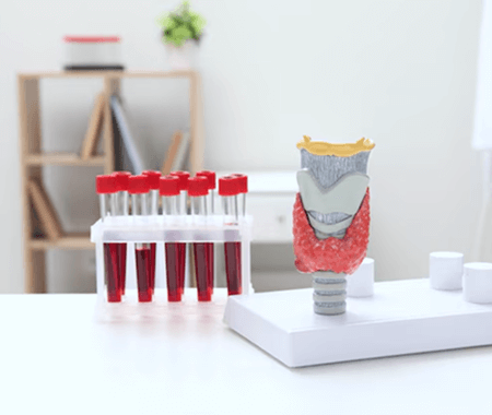 Service 8 illustration