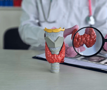 Service 3 illustration