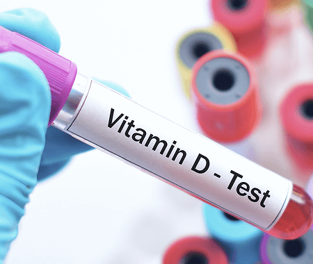 Service 35 illustration