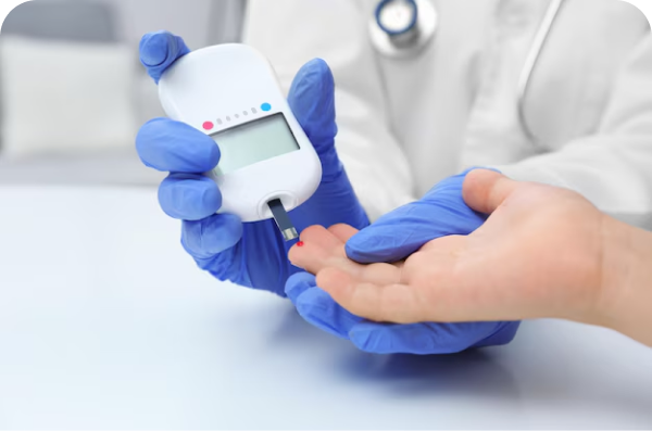 Service 4 illustration